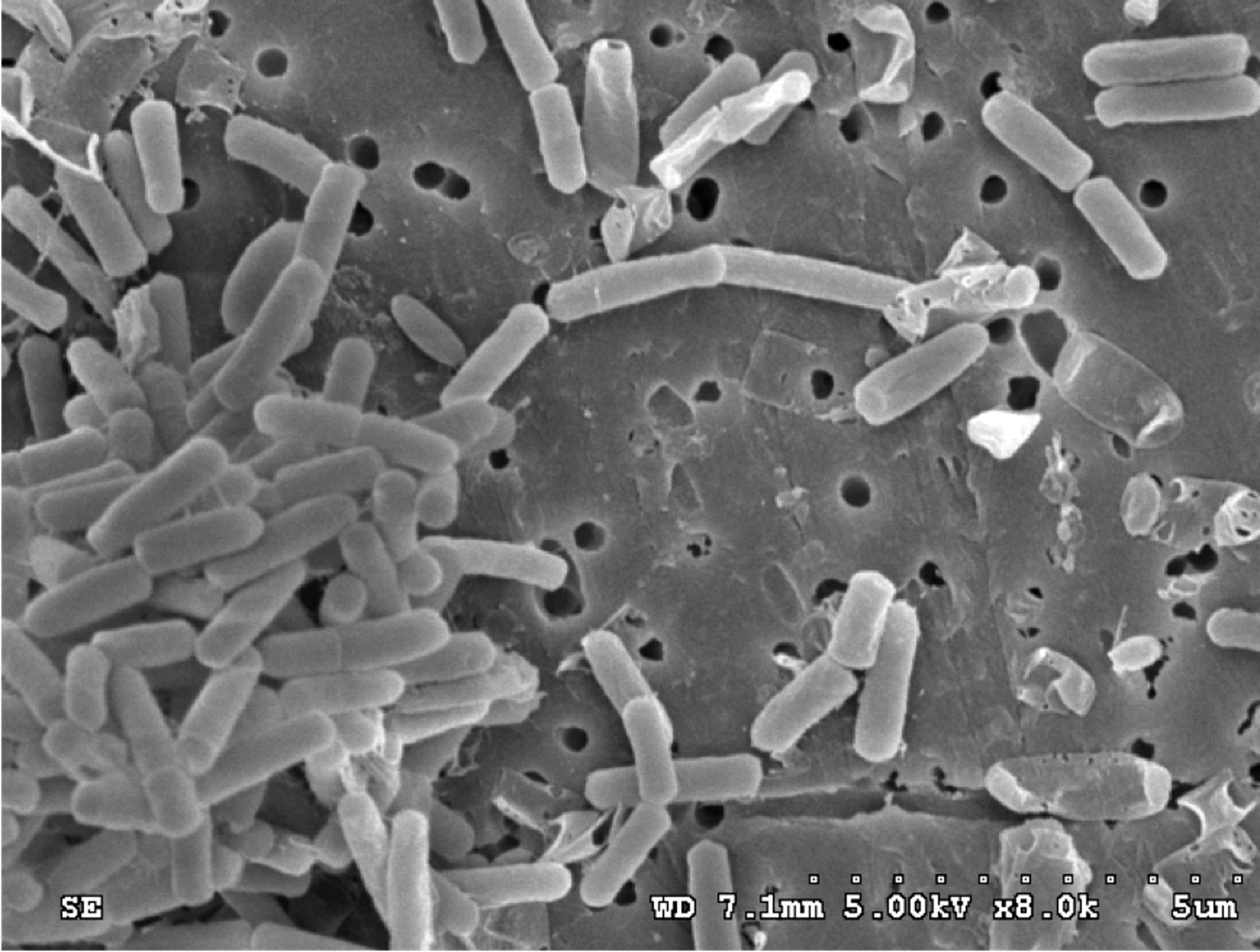 Reducing Sludge Through Bio-Augmentation - Canadian Pond